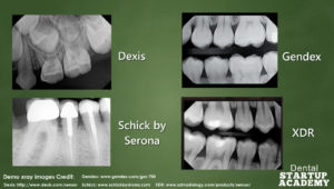 Dental sensor comparison
